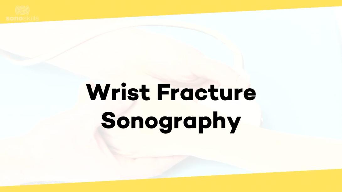 Wrist fractures