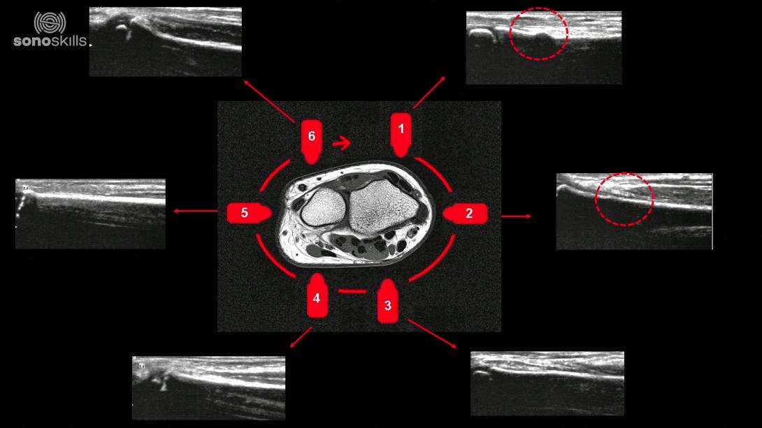 Pathology cases of wrist fractures