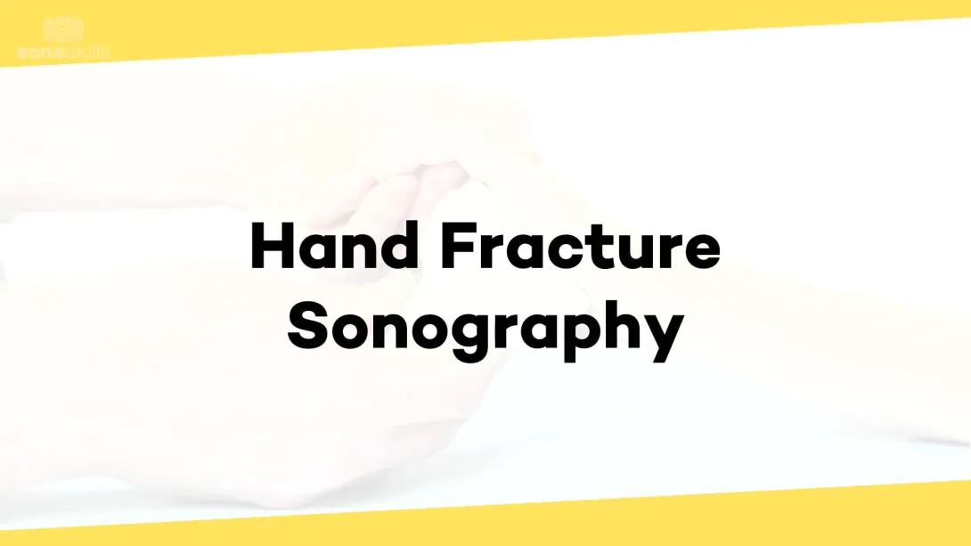 Hand fractures