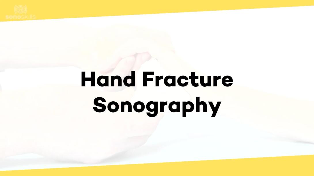 Hand fractures