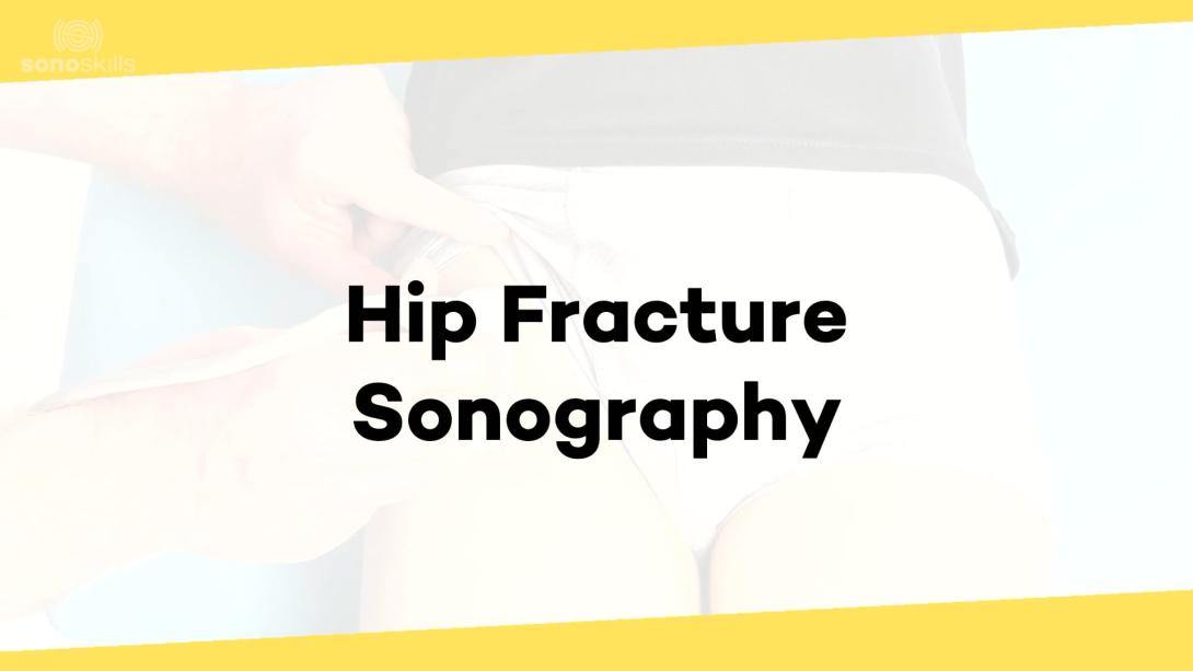 Hip fractures