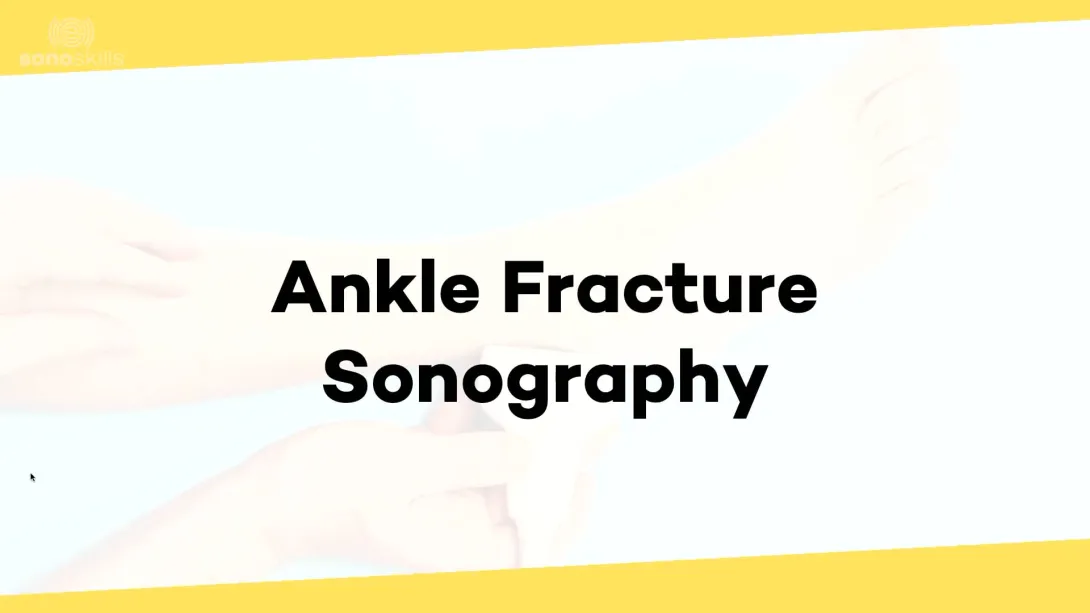 Ankle fractures