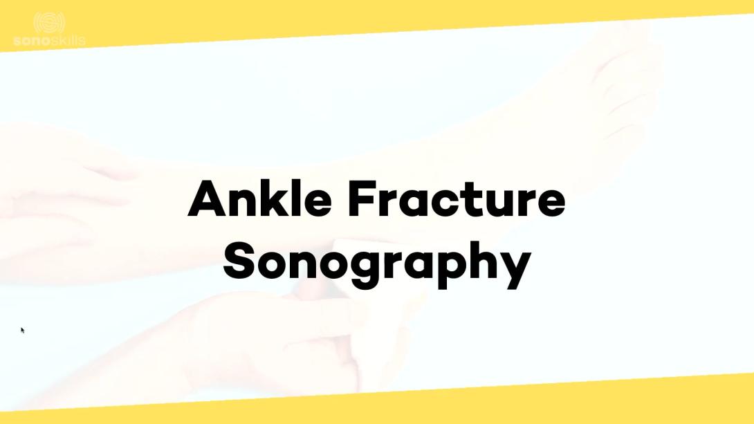 Ankle fractures