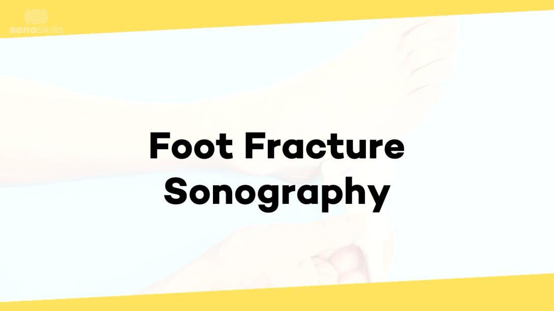 Foot fractures