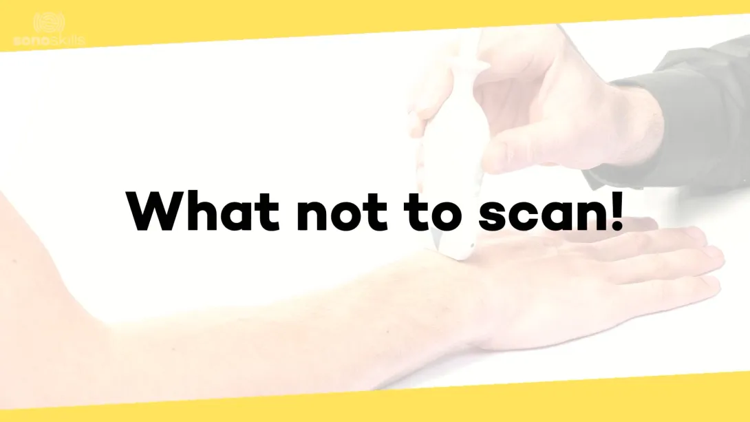 What not to scan!