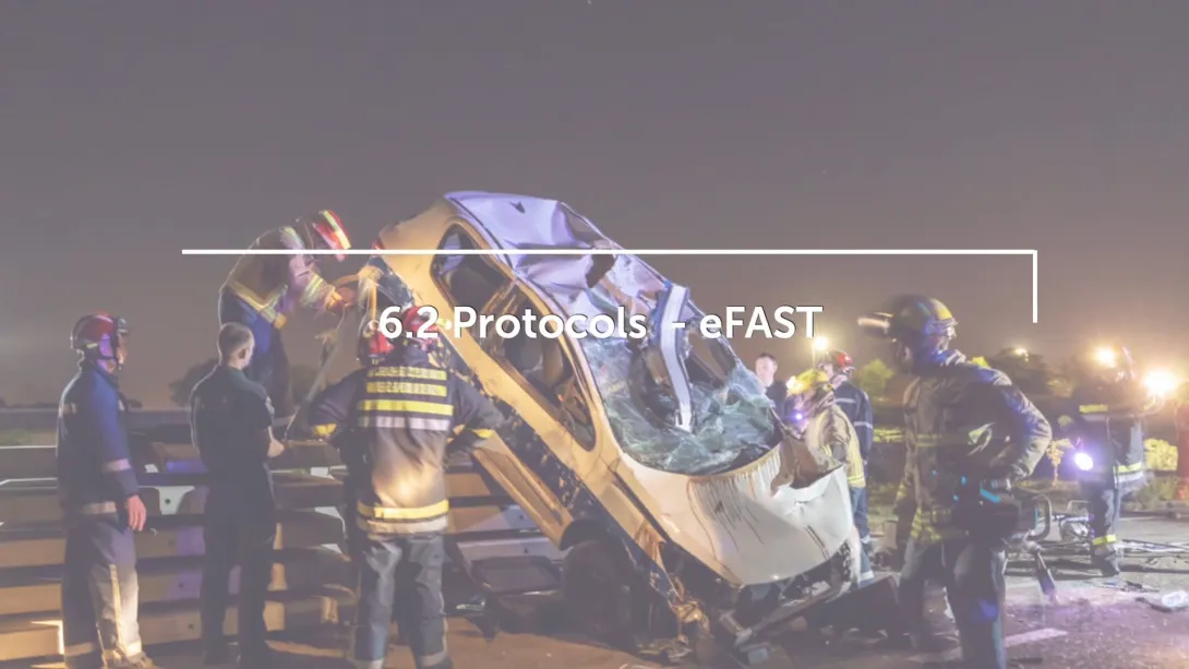 eFAST