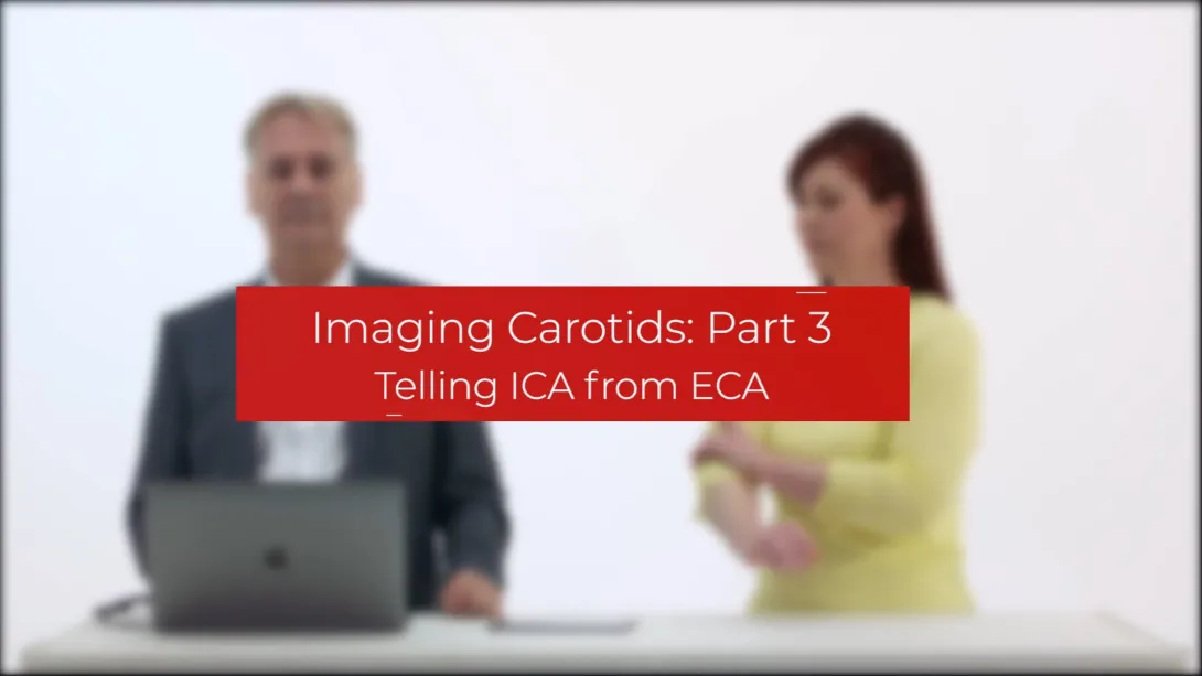Telling ICA from ECA