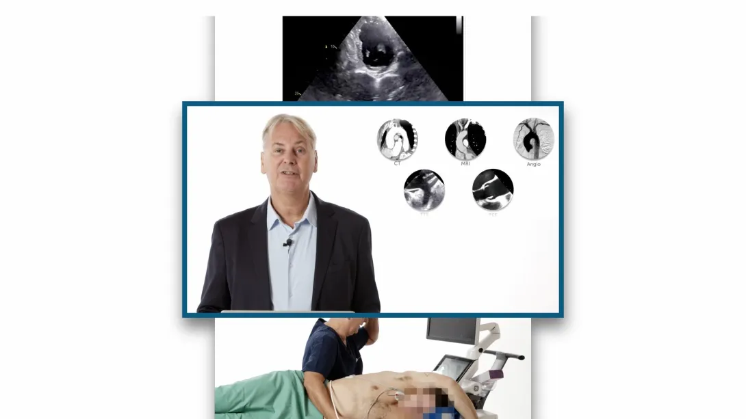 Dissection Features