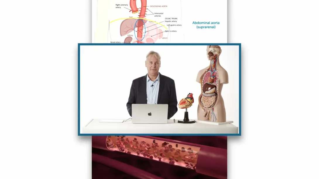 Indication for Surgery