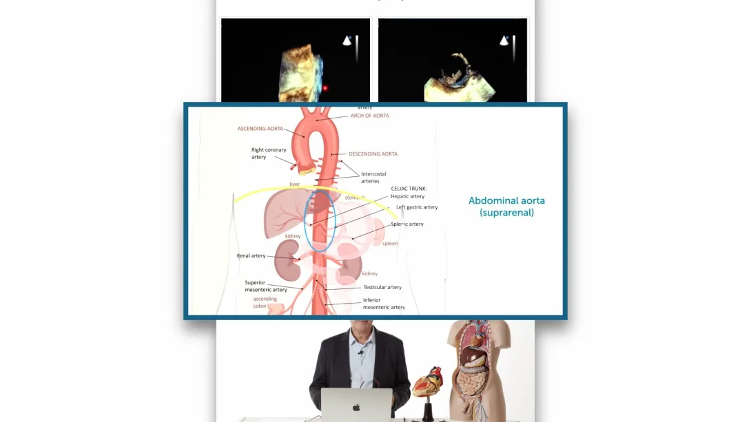 Imaging and Echo Findings