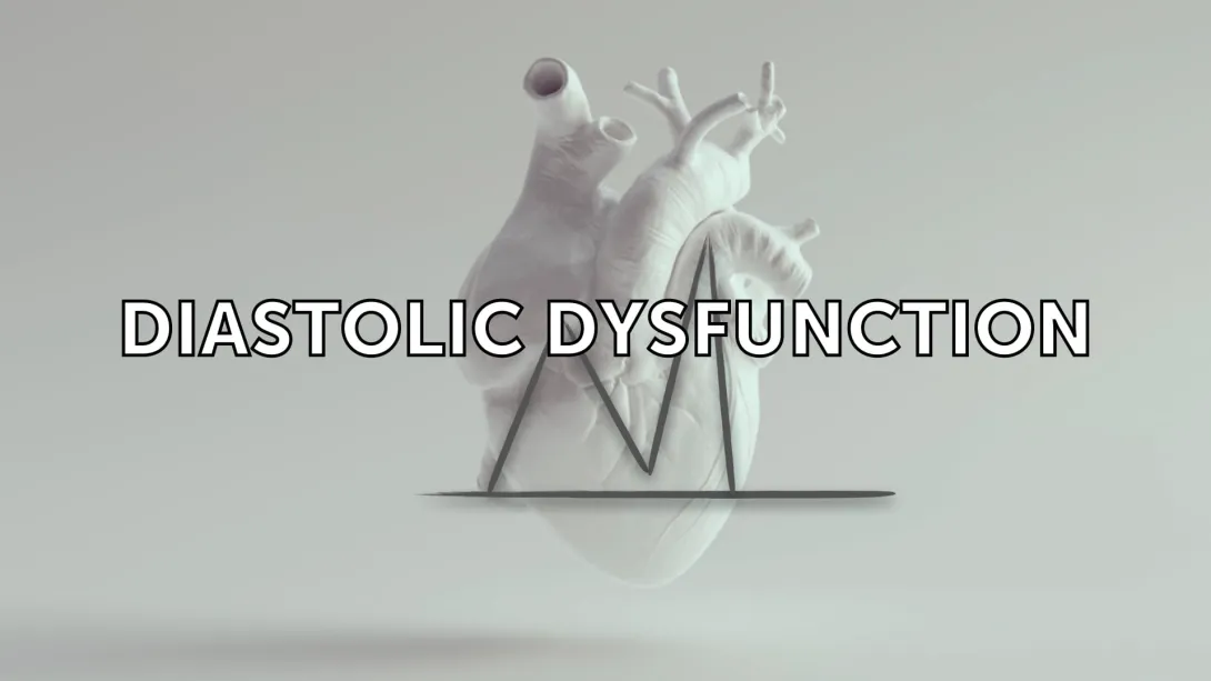 Assessment of Diastolic Dysfunction - Guidelines
