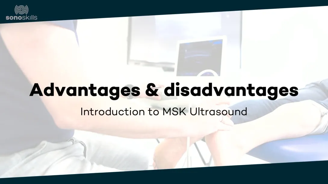 Advantages and disadvantages