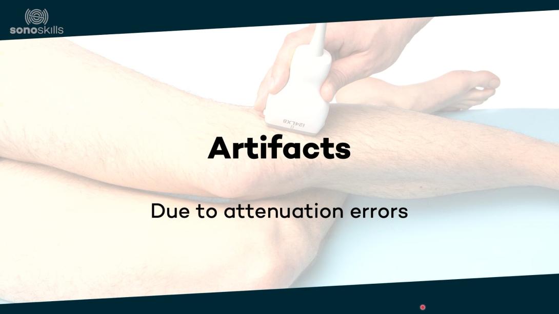 Artifacts due to attenuation errors