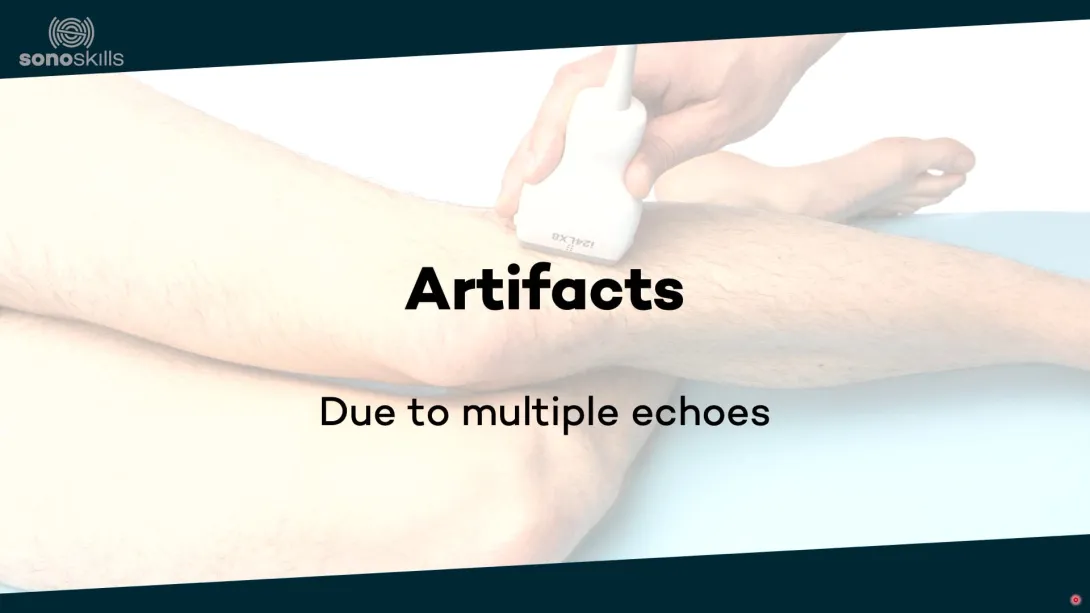 Artifacts due to multiple echoes