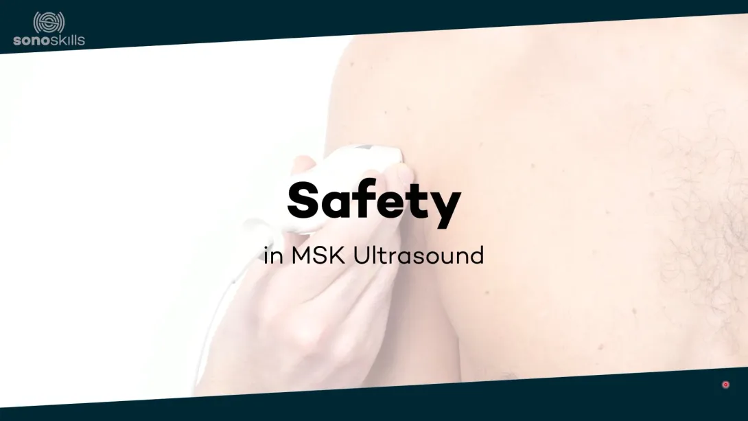 Safety 