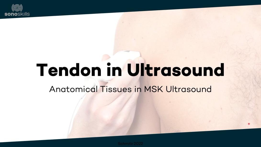 Tendon in ultrasound