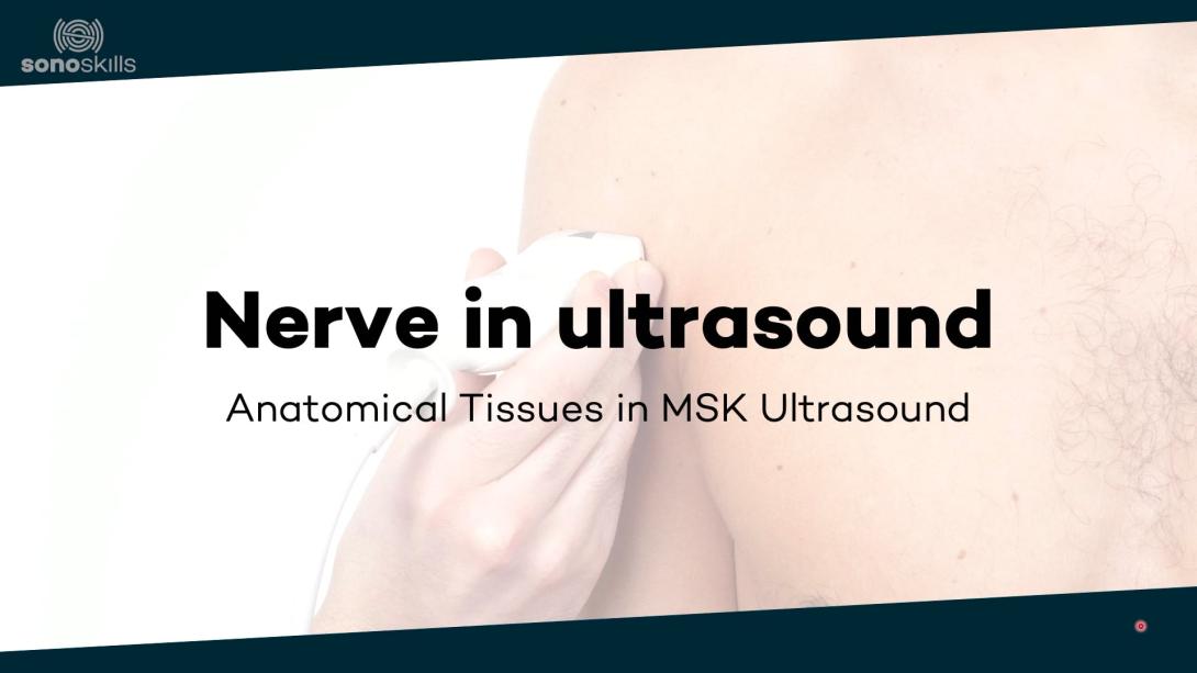 Nerve in ultrasound