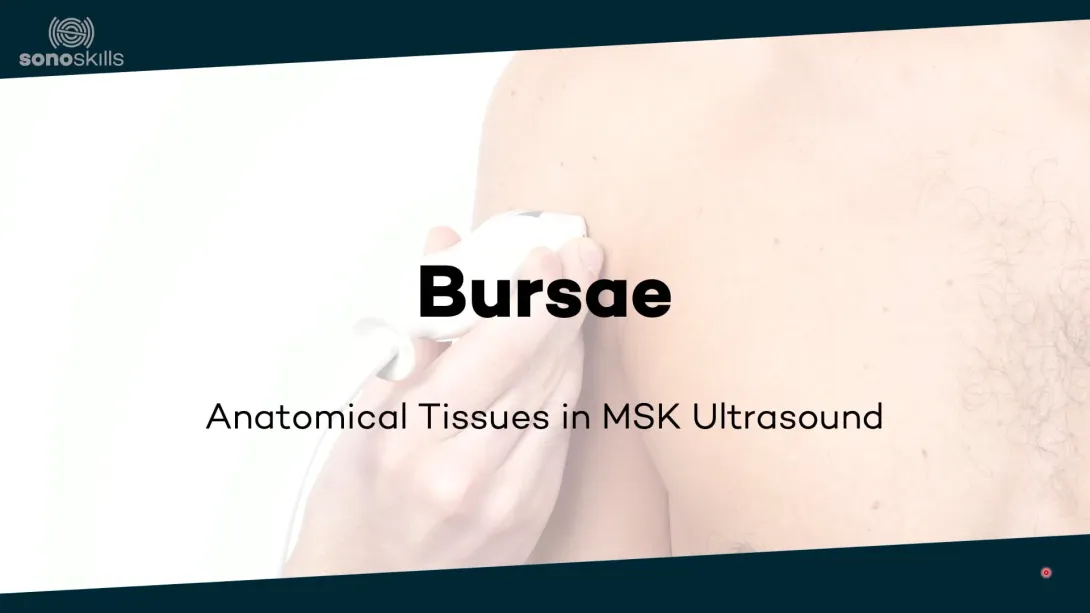 Bursae in ultrasound