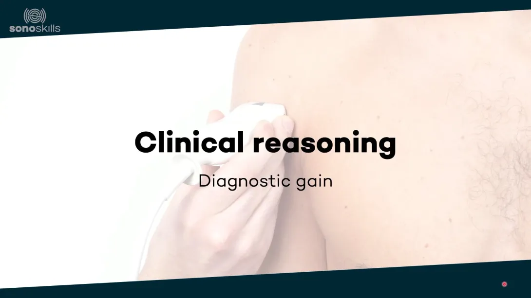 Diagnostic gain