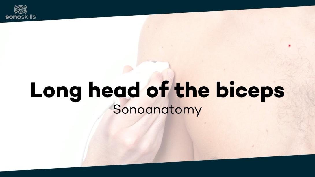 Long head of biceps - sonoanatomy