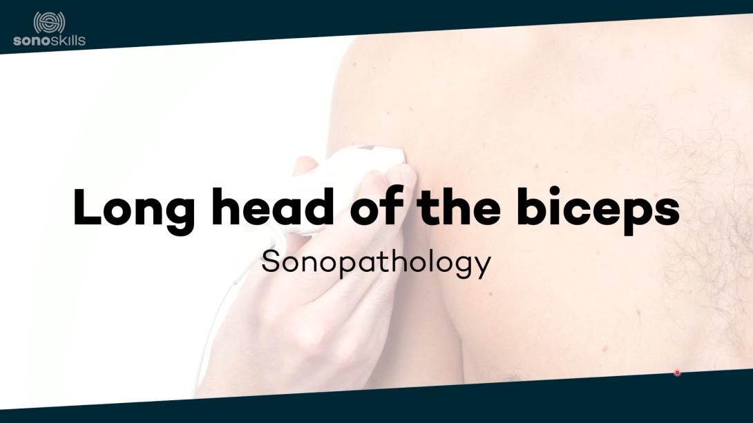 Long head of the biceps tendon - sonopathology