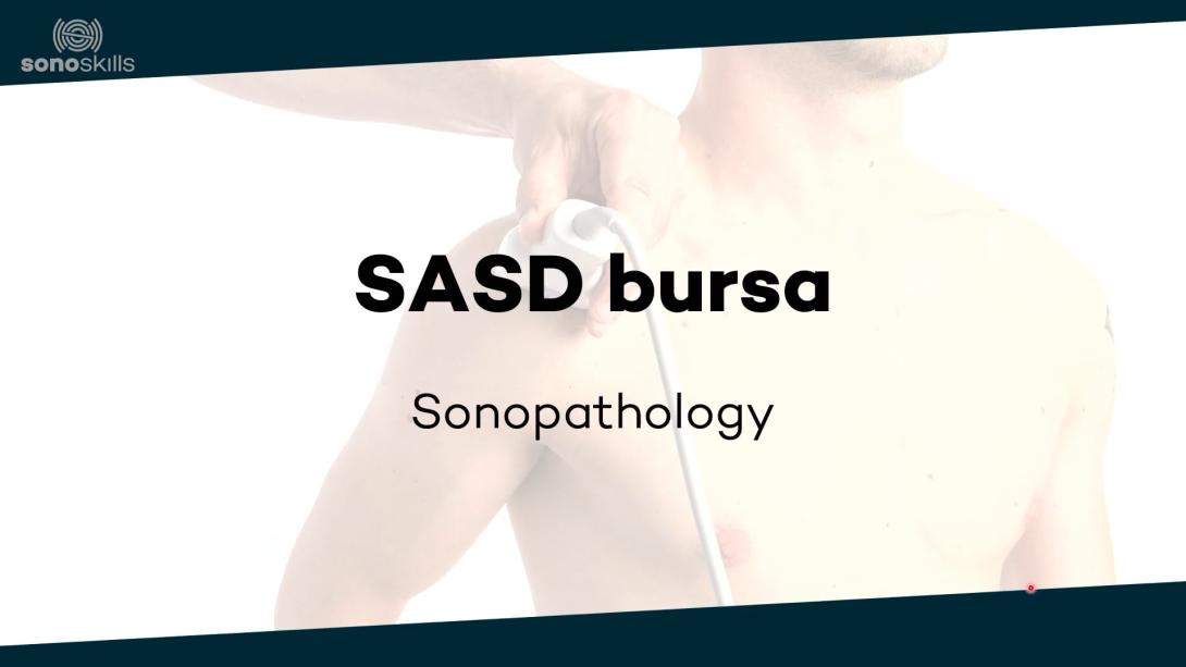 SASD bursa - sonopathology