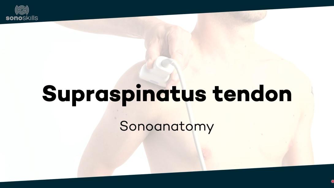Supraspinatus tendon - sonoanatomy