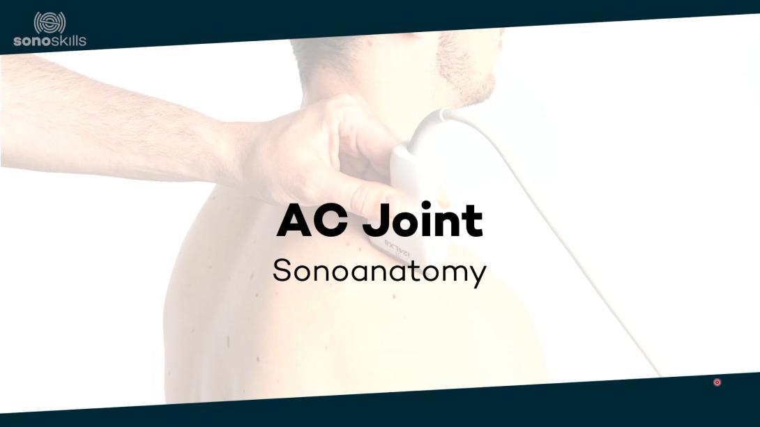 AC joint sonoanatomy