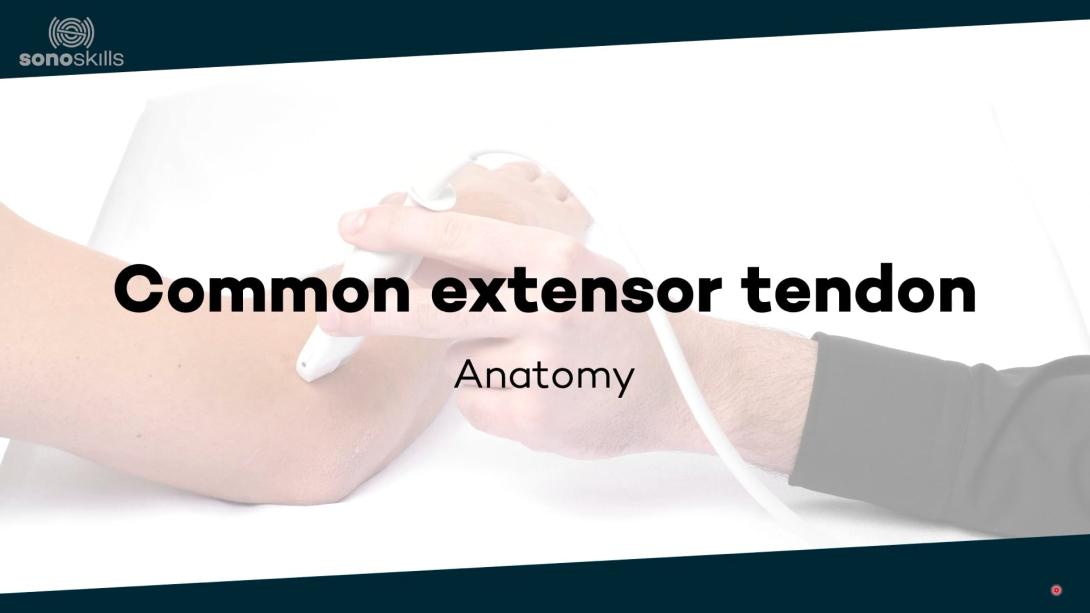 Common extensor tendon - anatomy