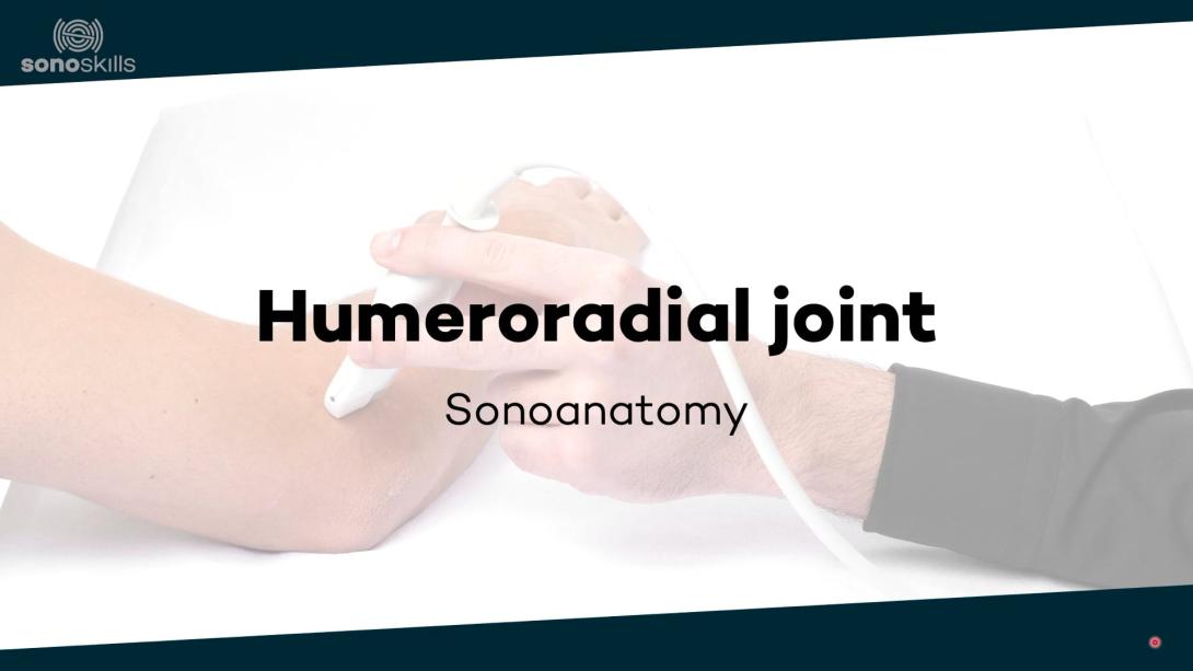 Humeroradial joint - sonoanatomy