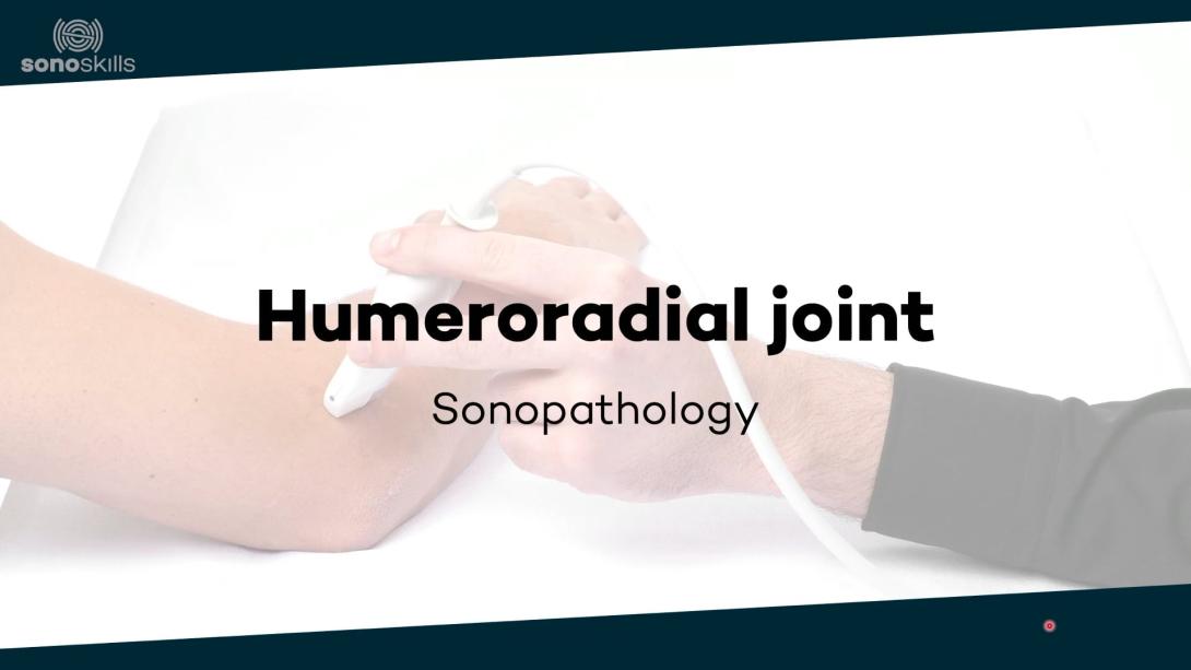Humeroradial joint - sonopathology