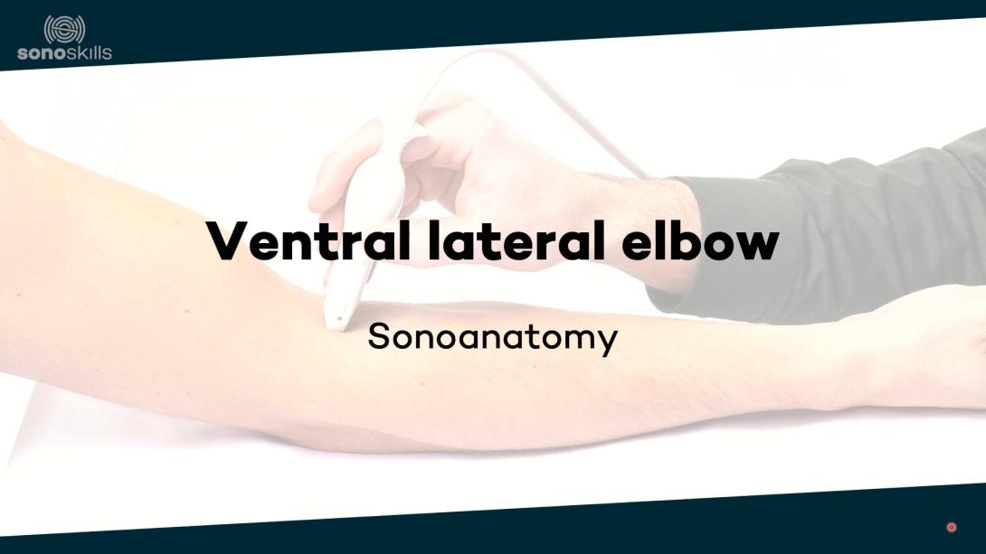 Ventral lateral elbow - sonoanatomy