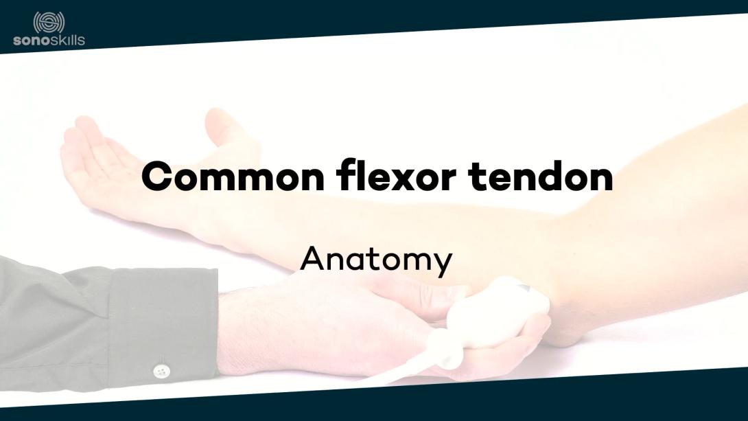 Common flexor tendon - anatomy