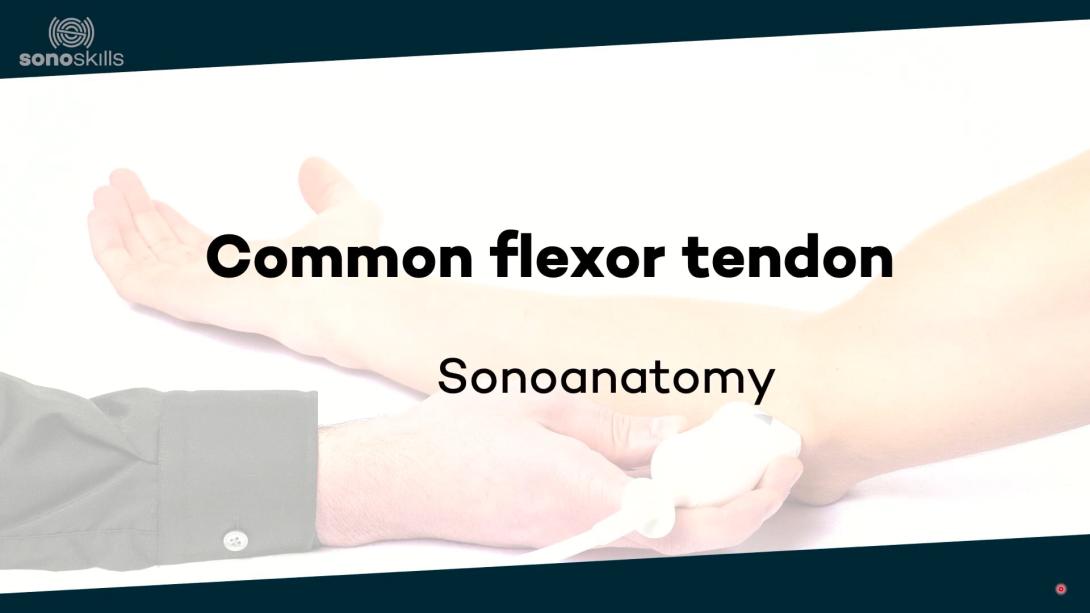 Common flexor tendon - sonoanatomy