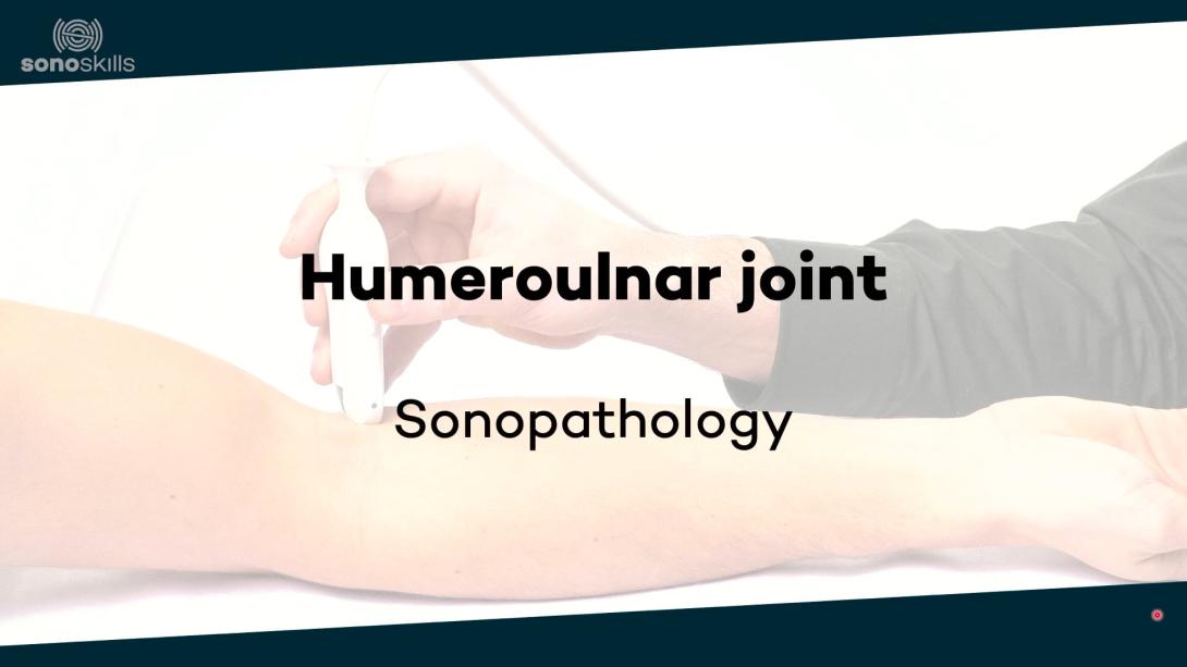 Humeroulnar joint  - Sonopathology