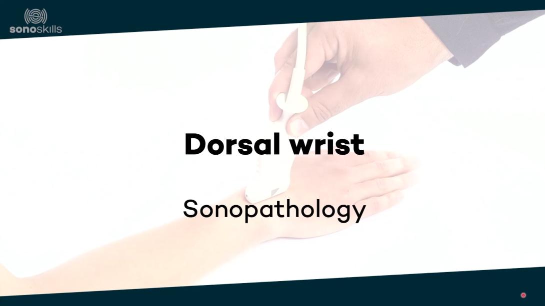 Dorsal wrist joints - Sonopathology