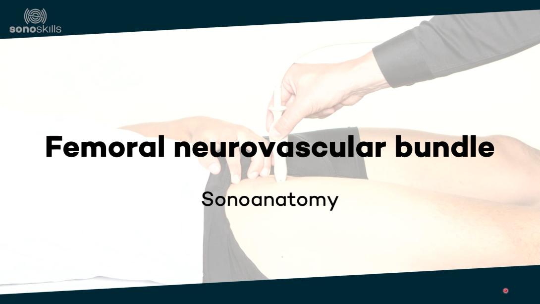 Femoral neurovascular bundle - sonoanatomy