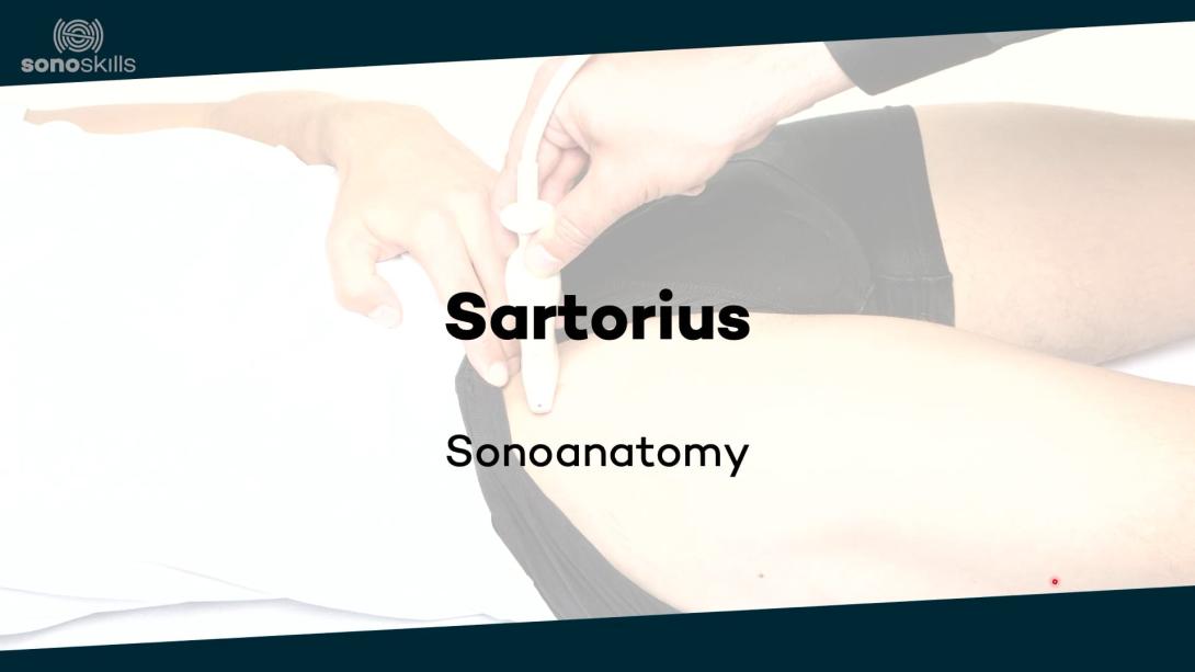 Sartorius - sonoanatomy