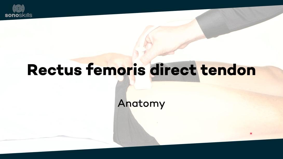 Rectus femoris direct tendon - anatomy