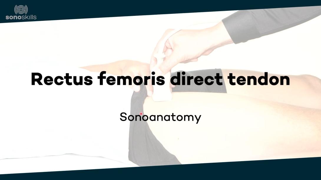 Rectus femoris direct tendon - sonoanatomy