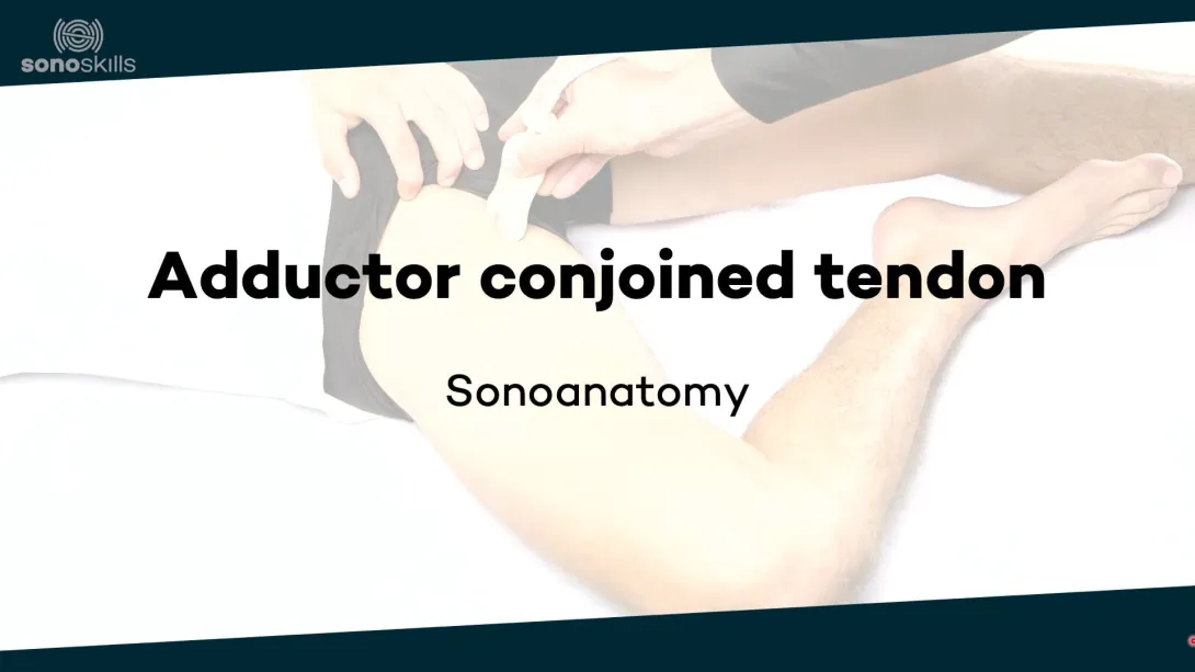Adductors - sonoanatomy