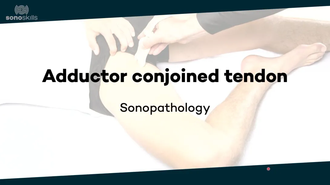 Adductors - sonopathology