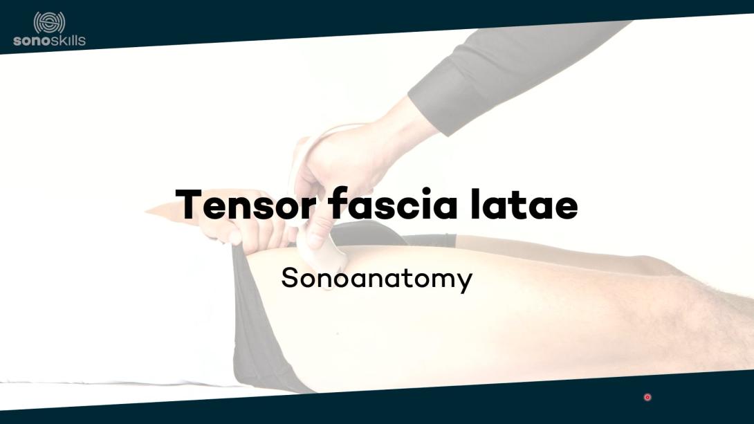 Tensor fascia latae - sonoanatomy