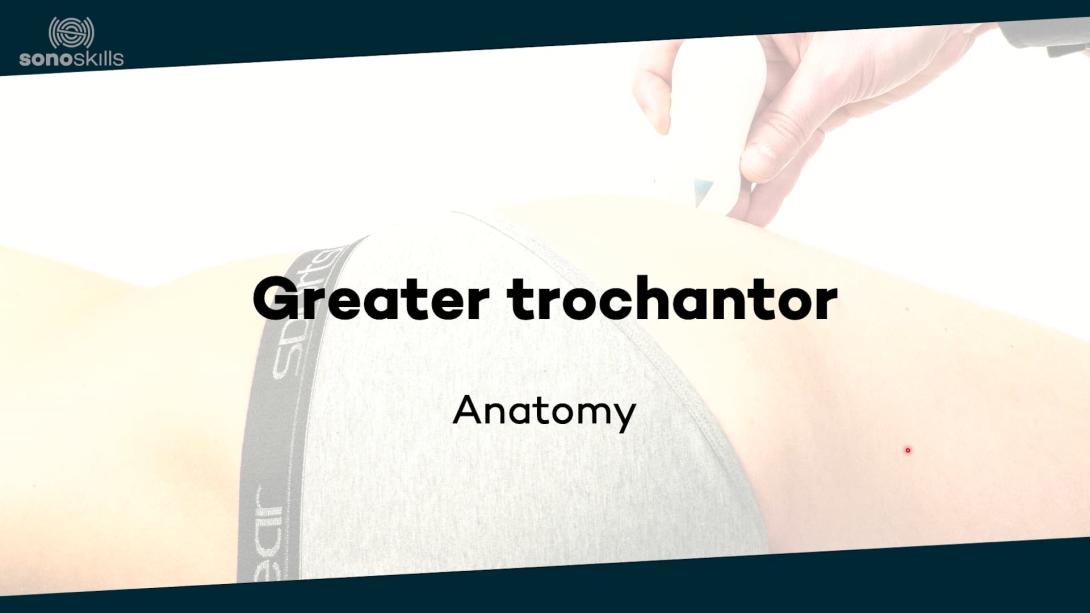 Greater trochantor - anatomy