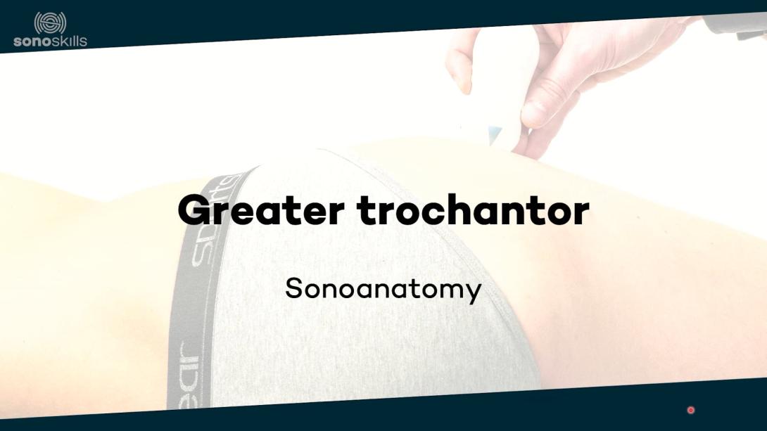 Greater trochantor - sonoanatomy