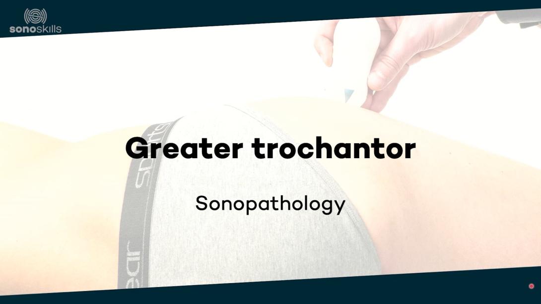 Greater trochantor - sonopathology