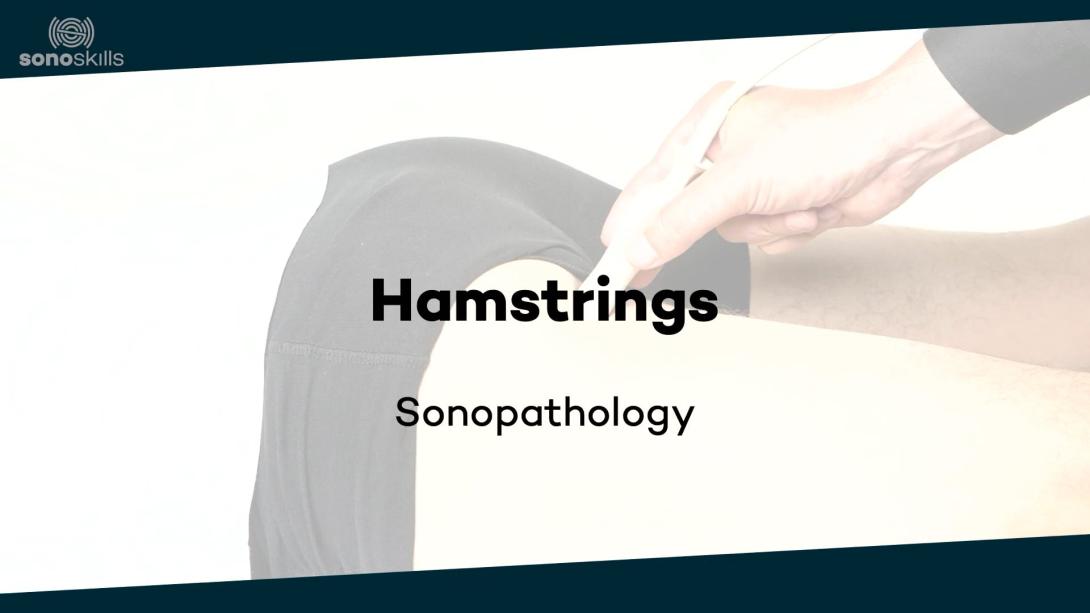 Hamstrings - sonopathology
