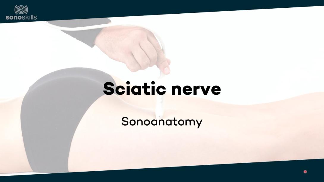 Sciatic nerve - sonoanatomy
