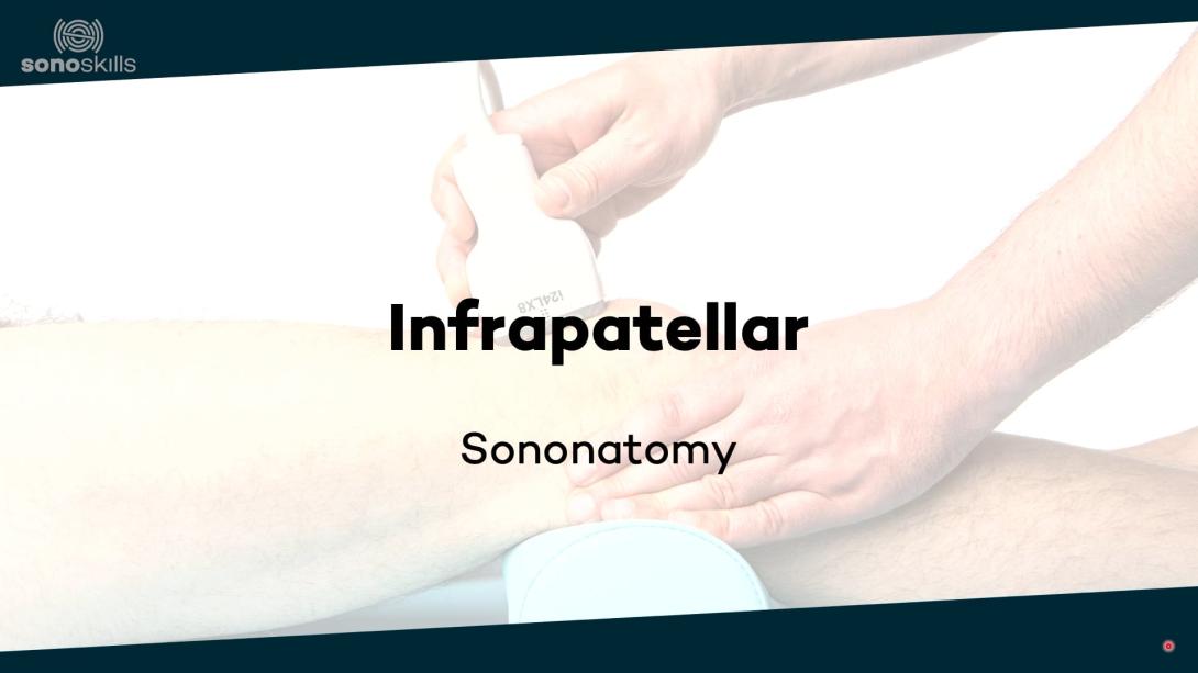 Infrapatellar - sonoanatomy