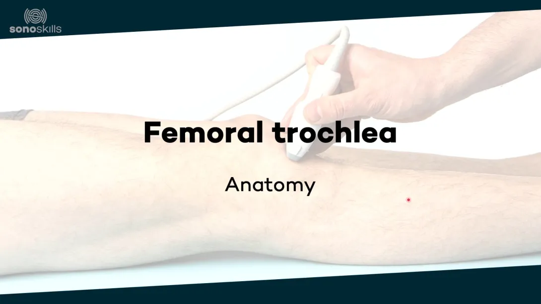 Femoral trochlea - anatomy
